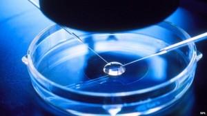 IVF-baby